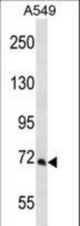 PCCA Antibody western blot of A549 cell line lysates (35 ug/lane). The PCCA antibody detected the PCCA protein (arrow).