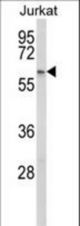 Western blot of PCCB Antibody in Jurkat cell line lysates (35 ug/lane). PCCB (arrow) was detected using the purified antibody.