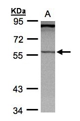 Sample (30g whole cell lysate). A: Hep G2 . 7.5% SDS PAGE. PCCB antibody diluted at 1:1000