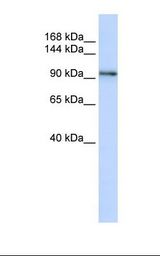 MCF7 cell lysate. Antibody concentration: 1.0 ug/ml. Gel concentration: 6-18%.