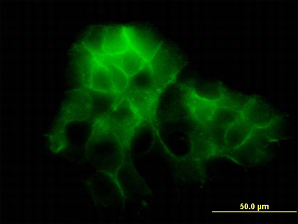 Immunofluorescence of monoclonal antibody to PCDH1 on A-431 cell. [antibody concentration 10 ug/ml]