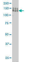 PCDH1 monoclonal antibody (M01), clone 5D5 Western blot of PCDH1 expression in A-431.