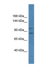 PCDH10 antibody LS-C145204 Western blot of Mouse Pancreas lysate. Antibody concentration 1 ug/ml.
