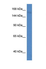 PCDH11X antibody LS-C145267 Western blot of Mouse Brain lysate. Antibody concentration 1 ug/ml.