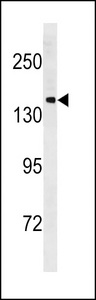 PCDH11Y Antibody western blot of NCI-H292 cell line lysates (35 ug/lane). The PCDH11Y antibody detected the PCDH11Y protein (arrow).
