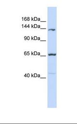 MCF7 cell lysate. Antibody concentration: 1.0 ug/ml. Gel concentration: 6-18%.
