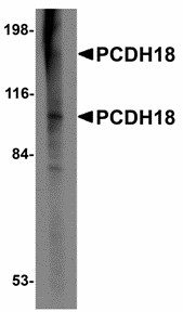 Western blot of PCDH18 in Raji cell lysate with PCDH18 antibody at 2 ug/ml. Below: Immunohistochemistry of PCDH18 in mouse brain tissue with PCDH18 antibody at 2.5 ug/ml.