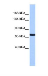 HepG2 cell lysate. Antibody concentration: 1.0 ug/ml. Gel concentration: 6%-18%.