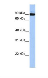 HepG2 cell lysate. Antibody concentration: 1.0 ug/ml. Gel concentration: 12%.