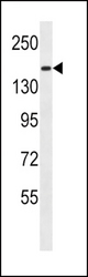 PCDH9 Antibody western blot of MDA-MB435 cell line lysates (35 ug/lane). The PCDH9 antibody detected the PCDH9 protein (arrow).