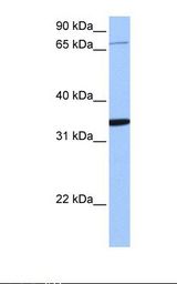 Jurkat cell lysate. Antibody concentration: 1.0 ug/ml. Gel concentration: 12%.
