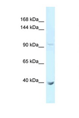PCDHA11 antibody LS-C146035 Western blot of 721_B Cell lysate. Antibody concentration 1 ug/ml.