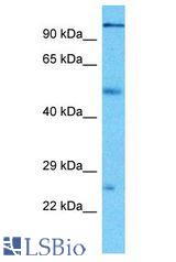 PCDHA3 antibody Western Blot of Thymus Tumor. Antibody dilution: 1 ug/ml.
