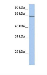 Hela cell lysate. Antibody concentration: 1.0 ug/ml. Gel concentration: 12%.