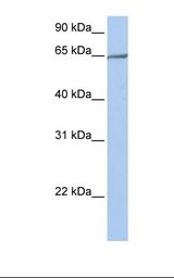 721_B cell lysate. Antibody concentration: 1.0 ug/ml. Gel concentration: 12%.
