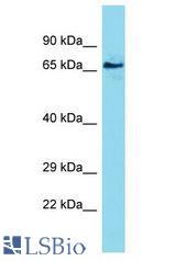 PCDHA6 antibody Western Blot of Stomach Tumor. Antibody dilution: 1 ug/ml.