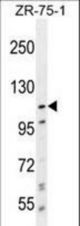PCDHA8 Antibody western blot of ZR-75-1 cell line lysates (35 ug/lane). The PCDHA8 antibody detected the PCDHA8 protein (arrow).