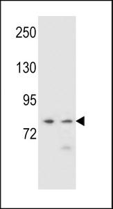 PCDHA9 Antibody western blot of NCI-H460,K562 cell line lysates (35 ug/lane). The PCDHA9 antibody detected the PCDHA9 protein (arrow).