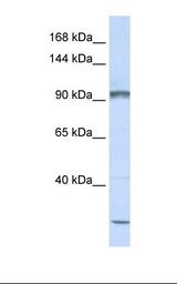 Jurkat cell lysate. Antibody concentration: 1.0 ug/ml. Gel concentration: 6-18%.