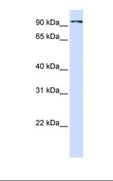 293T cell lysate. Antibody concentration: 1.0 ug/ml. Gel concentration: 12%.