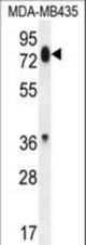 PCDHB13 Antibody western blot of MDA-MB435 cell line lysates (35 ug/lane). The PCDHB13 antibody detected the PCDHB13 protein (arrow).