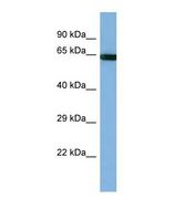 Western blot of Human HT1080 Whole cell . PCDHB14 antibody dilution 1.0 ug/ml.