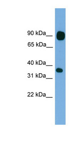 PCDHB15 antibody LS-C116363 Western blot of HeLa lysate.