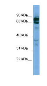 PCDHB16 antibody LS-C117250 Western blot of Jurkat lysate.
