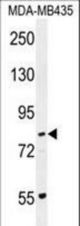PCDHGA1 Antibody western blot of MDA-MB435 cell line lysates (35 ug/lane). The PCDHGA1 antibody detected the PCDHGA1 protein (arrow).