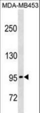 PCDHGA5 Antibody western blot of MDA-MB453 cell line lysates (35 ug/lane). The PCDHGA5 Antibody detected the PCDHGA5 protein (arrow).