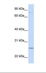 721_B cell lysate. Antibody concentration: 1.0 ug/ml. Gel concentration: 12%.