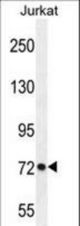 PCDHGC3 Antibody western blot of Jurkat cell line lysates (35 ug/lane). The PCDHGC3 antibody detected the PCDHGC3 protein (arrow).