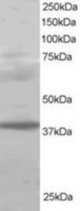 PCGF2 antibody staining (1 ug/ml) of Human Lung lysate (RIPA buffer, 30g total protein per lane). Primary incubated for 1 hour. Detected by Western blot of chemiluminescence.