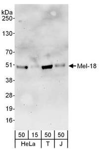Detection of Human Mel-18 by Western Blot. Samples: Whole cell lysate from HeLa (15 and 50 ug), 293T (T; 50 ug) and Jurkat (J; 50 ug) cells. Antibodies: Affinity purified rabbit anti-Mel-18 antibody used for WB at 0.1 ug/ml. Detection: Chemiluminescence with an exposure time of 3 minutes.