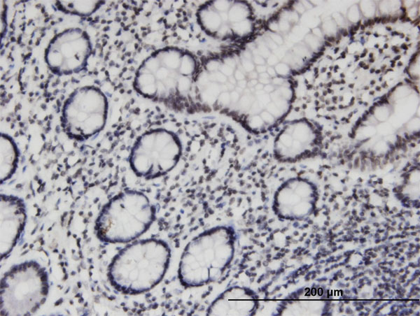 Immunoperoxidase of monoclonal antibody to PCGF3 on formalin-fixed paraffin-embedded human small Intestine. [antibody concentration 3 ug/ml]