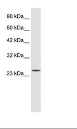 Jurkat Cell Lysate