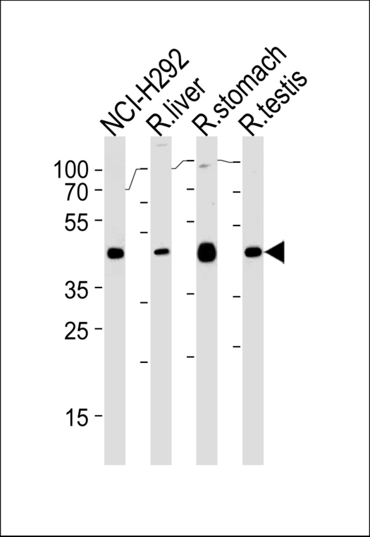 PCGF6 Antibody western blot of NCI-H292,rat liver,stomach and testis cell line lysates (35 ug/lane). The PCGF6 antibody detected the PCGF6 protein (arrow).