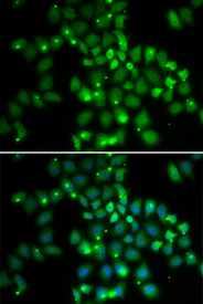 Immunofluorescence blot of HeLa cell using PCGF6 antibody. Blue: DAPI for nuclear staining.