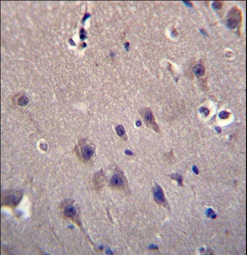 MCF2 Antibody immunohistochemistry of formalin-fixed and paraffin-embedded human brain tissue followed by peroxidase-conjugated secondary antibody and DAB staining.