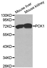 Western blot analysis of extracts of various cell lines, using PCK1 antibody.