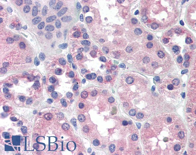 Anti-PCK1 antibody IHC of human kidney. Immunohistochemistry of formalin-fixed, paraffin-embedded tissue after heat-induced antigen retrieval. Antibody LS-B3032 concentration 2 ug/ml.