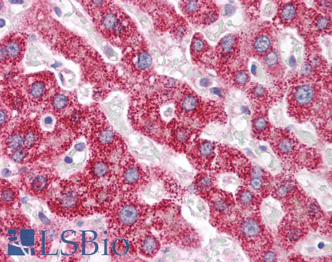 Anti-PCK1 antibody IHC of human liver. Immunohistochemistry of formalin-fixed, paraffin-embedded tissue after heat-induced antigen retrieval. Antibody LS-B1555 concentration 5 ug/ml.