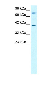 PCK1 antibody LS-B1555 Western blot of Jurkat lysate.