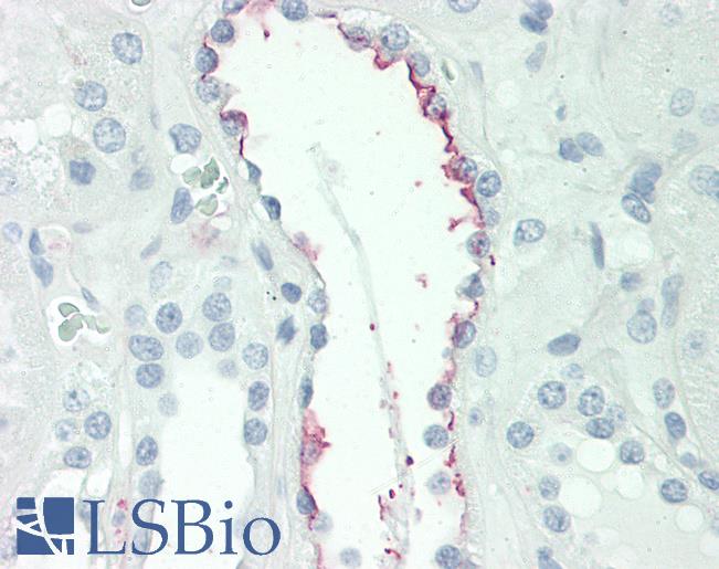 Human Kidney: Formalin-Fixed, Paraffin-Embedded (FFPE)