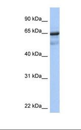 Placenta lysate. Antibody concentration: 1.0 ug/ml. Gel concentration: 12%.
