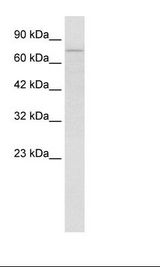 Jurkat Cell Lysate