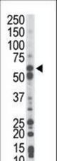 The anti-PCK1 antibody is used in Western blot to detect PCK1 in mouse liver tissue lysate.
