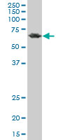 PCK2 monoclonal antibody (M05), clone 2C9. Western Blot analysis of PCK2 expression in A-431.