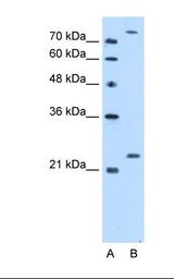 Lane A: Marker. Lane B: HepG2 cell lysate. Antibody concentration: 2.5 ug/ml. Gel concentration: 12%.