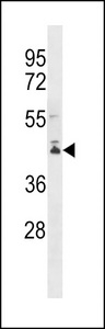 PCMTD2 Antibody western blot of ZR-75-1 cell line lysates (35 ug/lane). The PCMTD2 antibody detected the PCMTD2 protein (arrow).